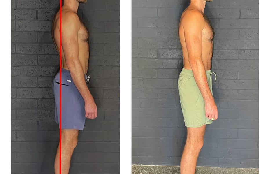 Gait and posture assessment