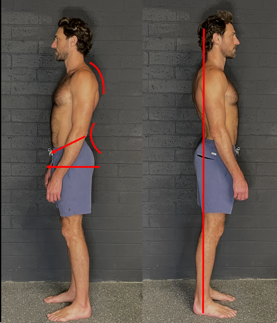 Before and after posture comparison